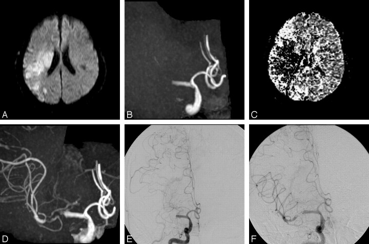 Fig 2.