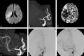 Fig 2.