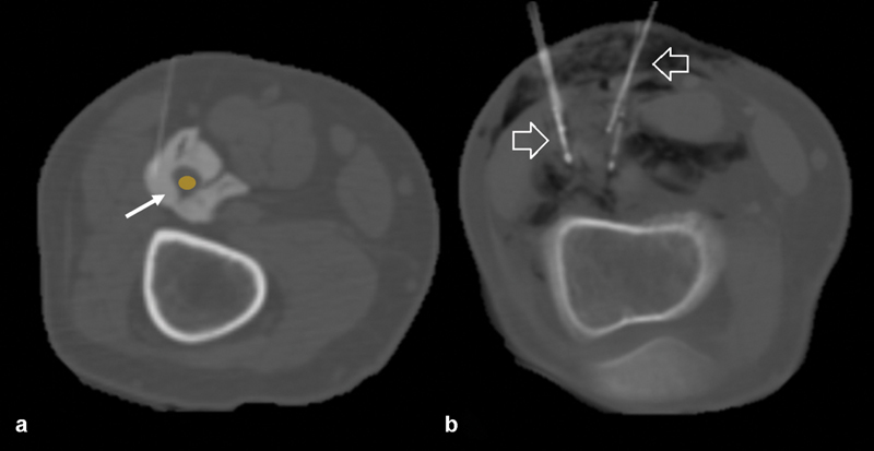 Fig. 8