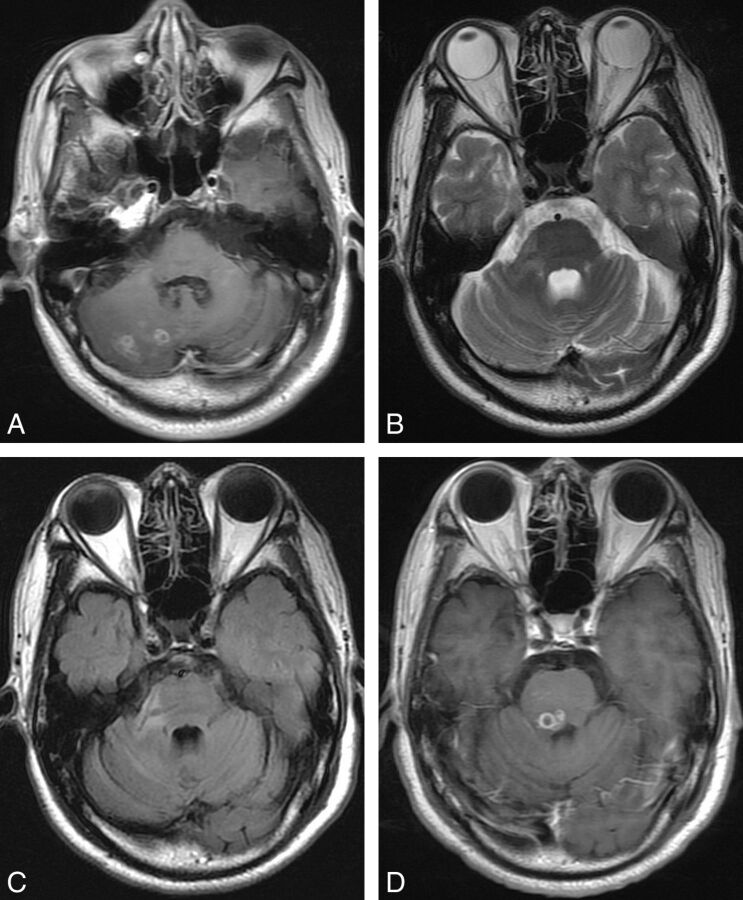 Fig 4.