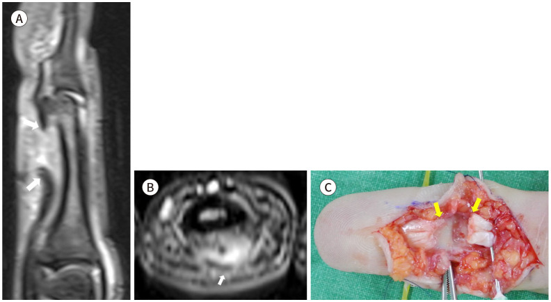 Fig. 16