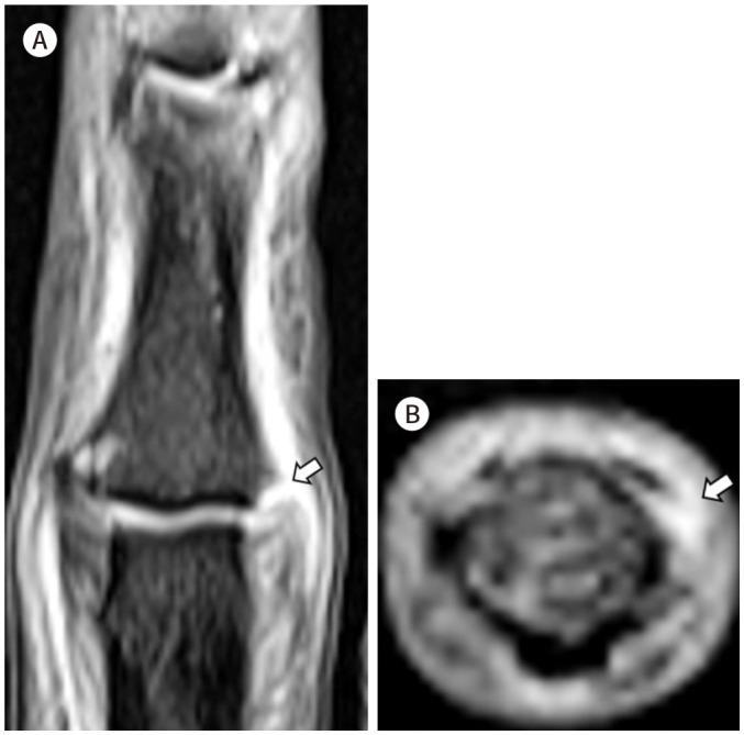 Fig. 13