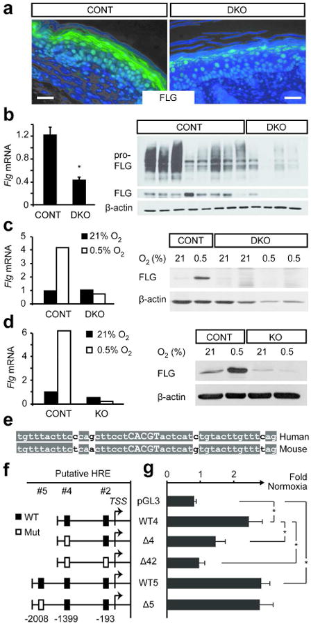 Hypoxia inducible factors regulate filaggrin expression and epidermal ...