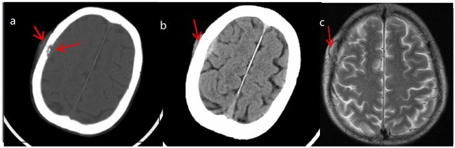 Figure 2.