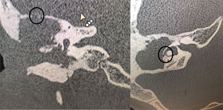 Fig. 2