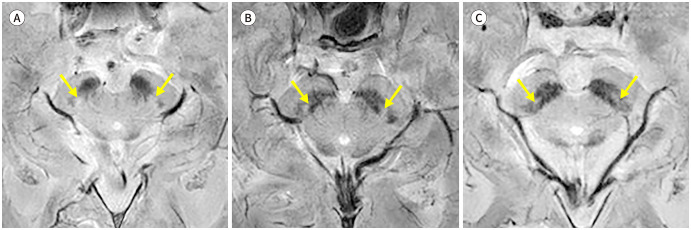 Fig. 4