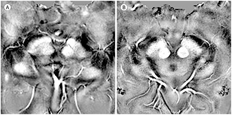 Fig. 10