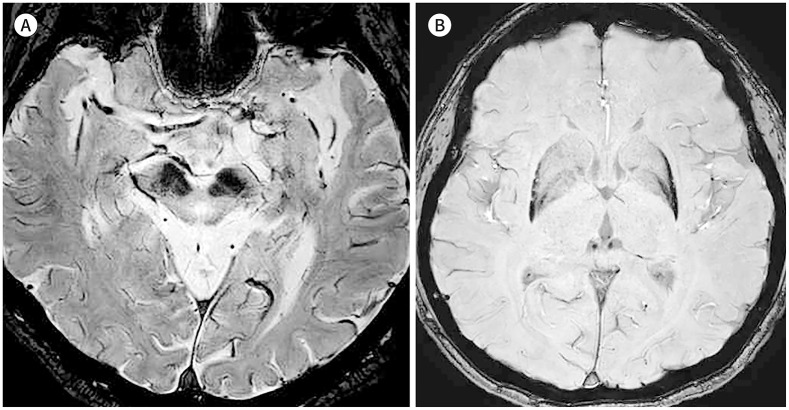 Fig. 11