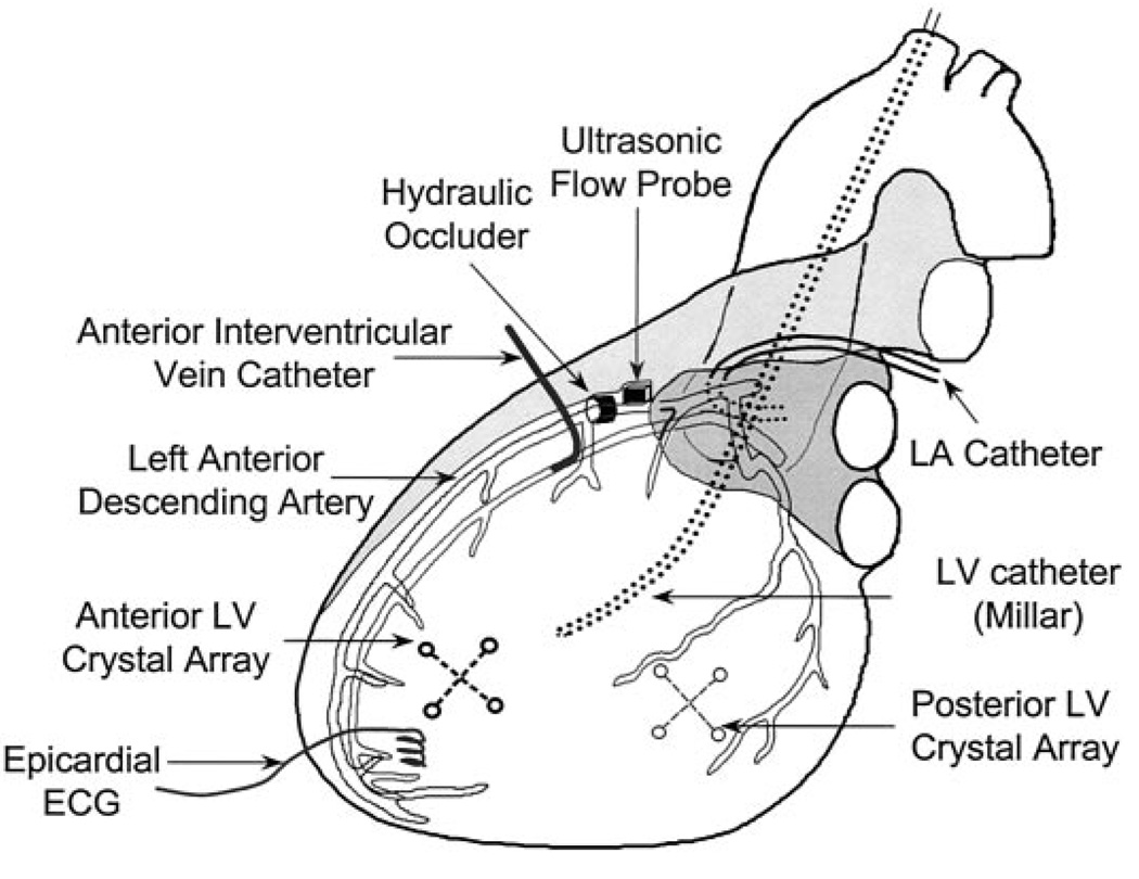 FIG. 1