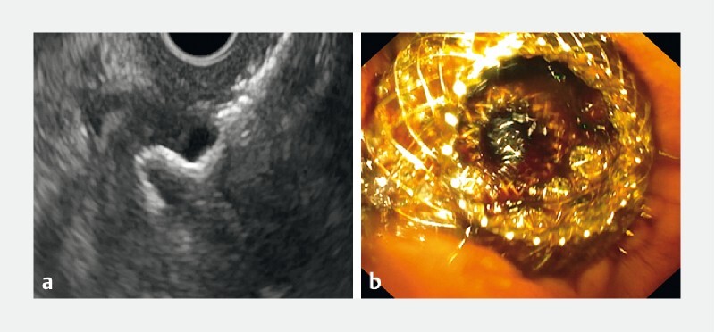 Fig. 1 a