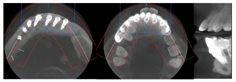 Figure 14