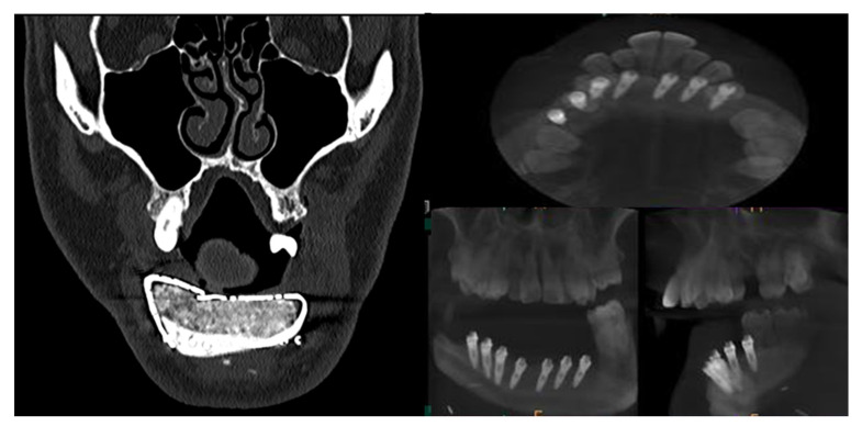 Figure 13