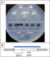 FIG 3