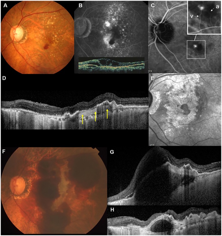 Fig 2