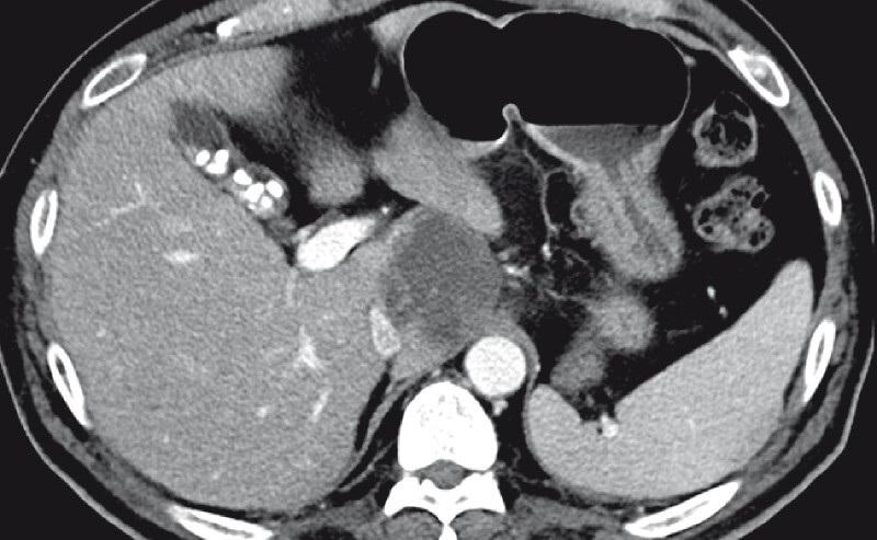 Fig. 1