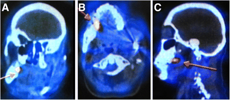 Fig. 2