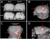 Fig. (1)