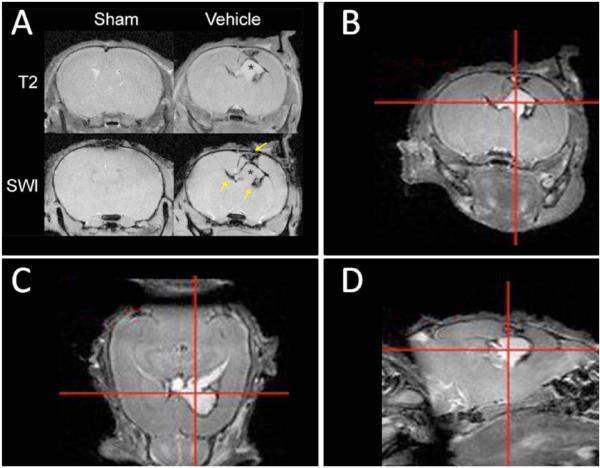 Fig. (1)