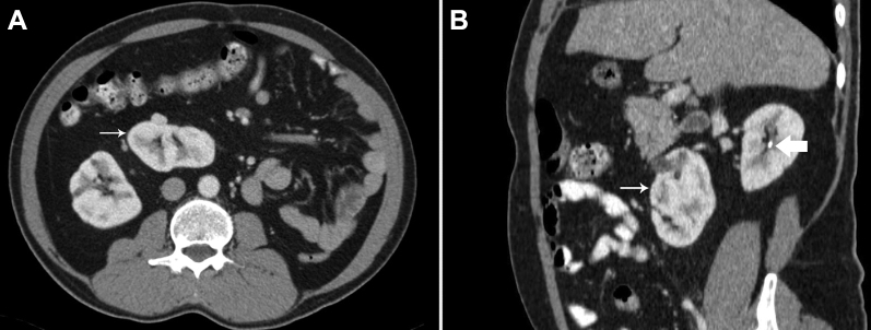 Fig. 2