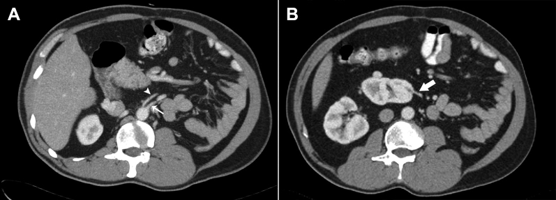 Fig. 3