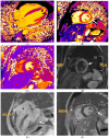 Figure 16