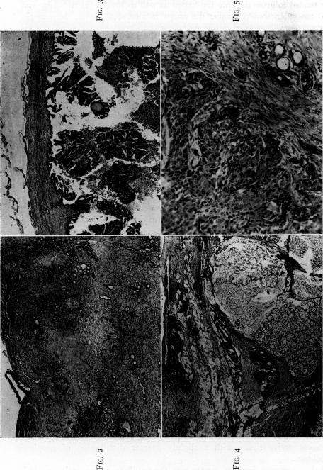 Fig. 2., Fig. 3., Fig. 4., Fig. 5.