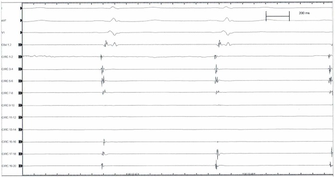 Figure 2A: 