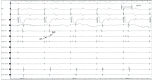 Figure 2B: