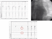 Figure 8B: