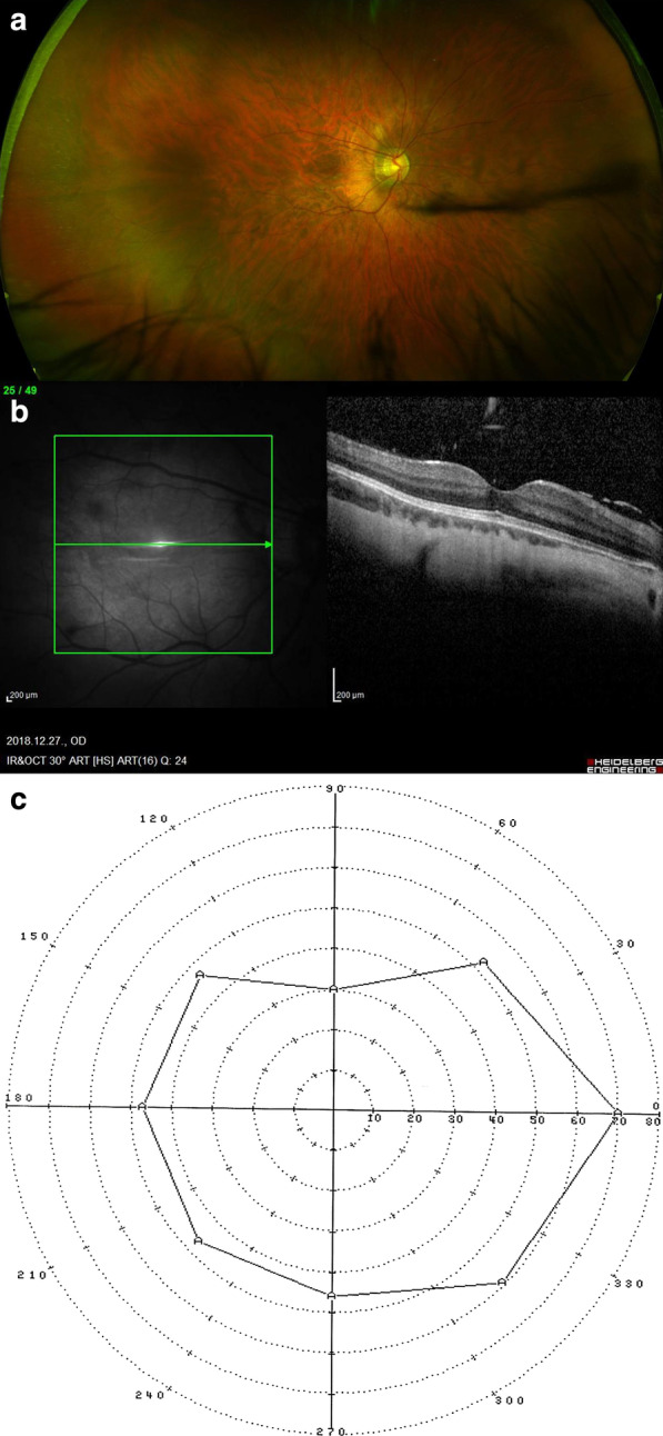 Fig. 2