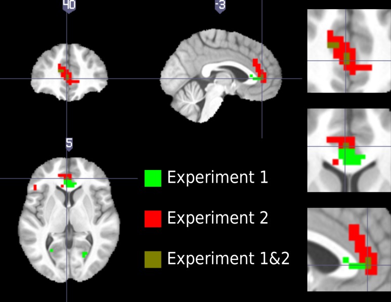 Figure 5—figure supplement 1.