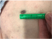 FIGURE 1