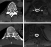 Fig 2.