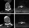 Fig 4.