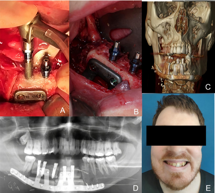 Figure 4