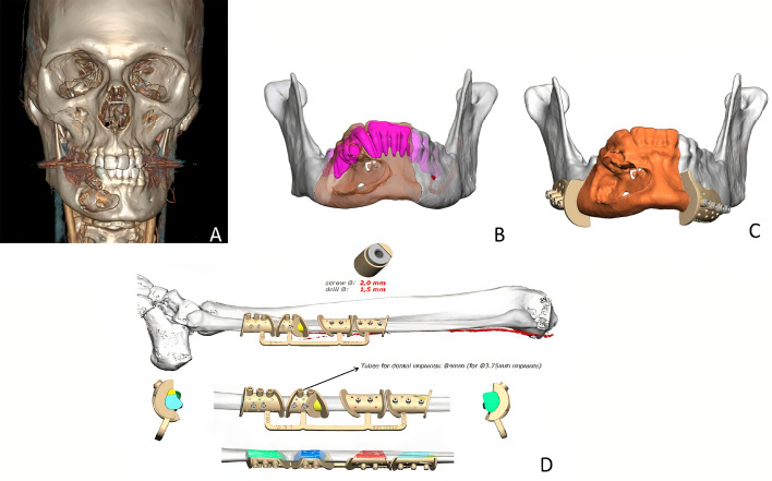 Figure 1