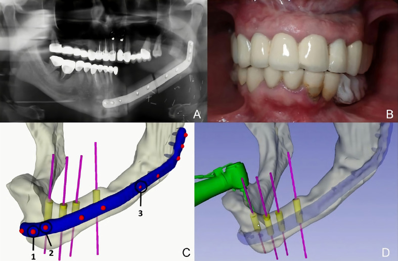 Figure 10