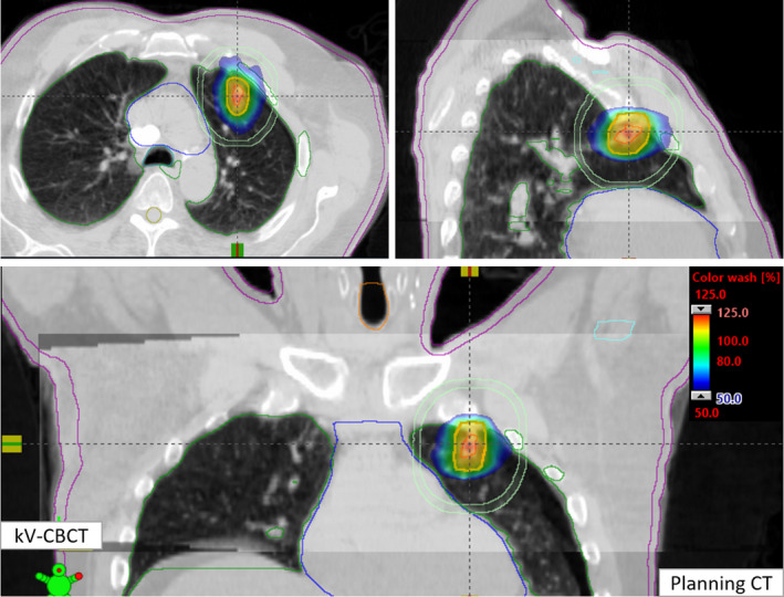 FIG. 3