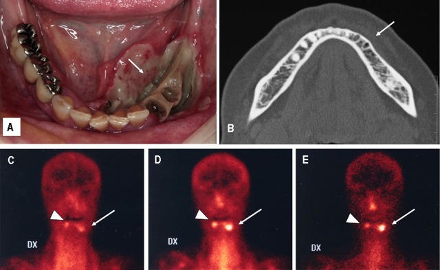 Figure 1