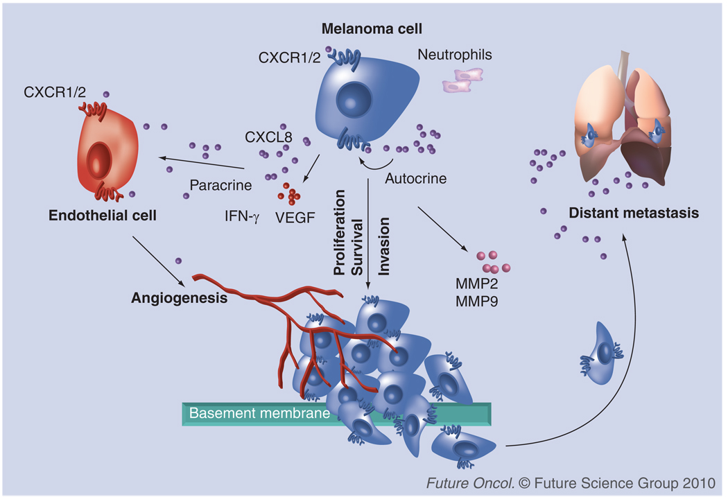 CXCL8 and its cognate receptors in melanoma progression and metastasis ...