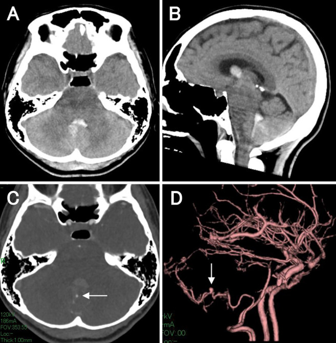 FIG. 1.