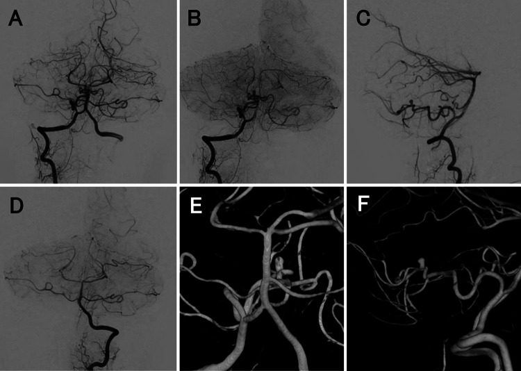 FIG. 2.