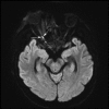 Figure 2a.