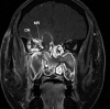 Figure 1a.