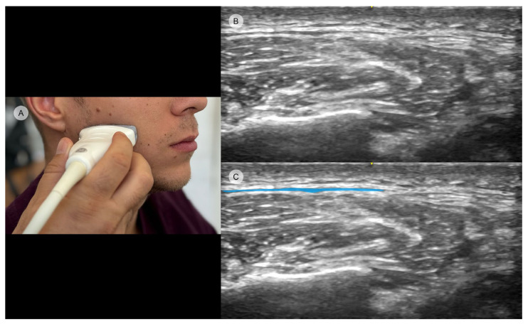 Figure 6