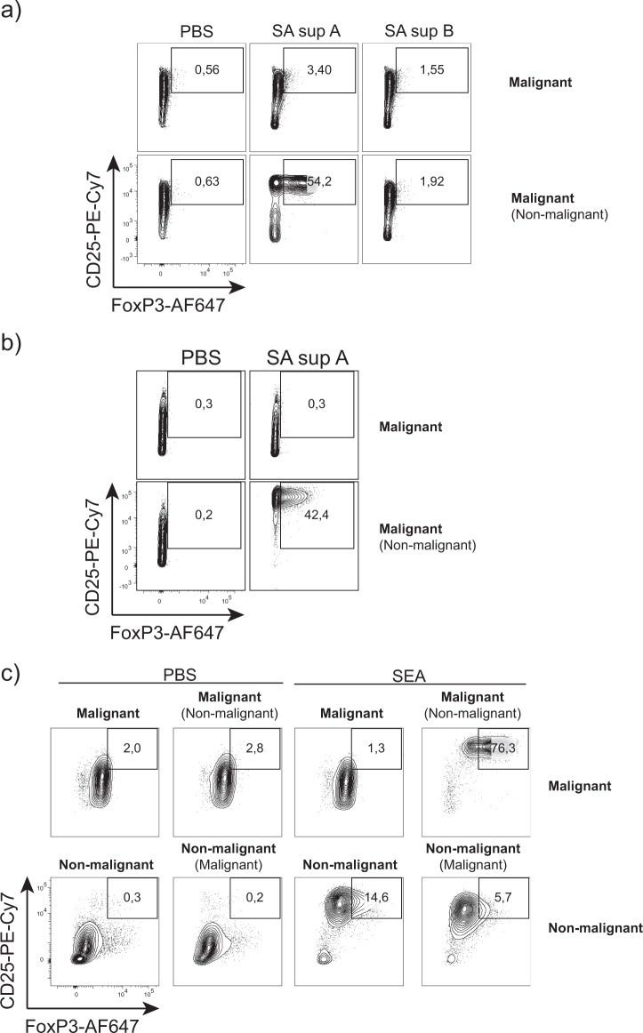 Staphylococcus aureus enterotoxins induce FOXP3 in neoplastic T cells ...