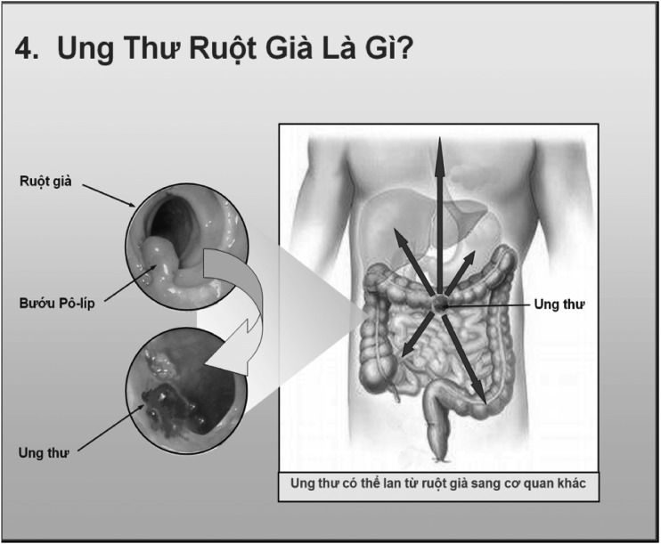 FIGURE 1—