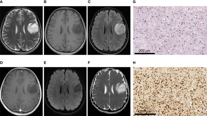 Figure 2