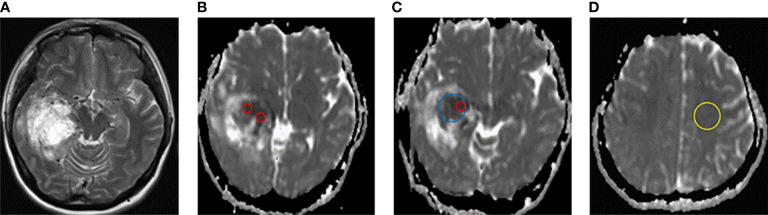 Figure 1