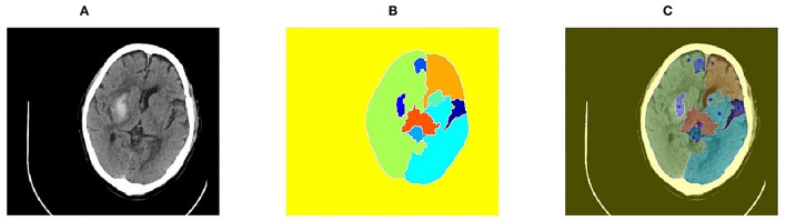 Figure 2